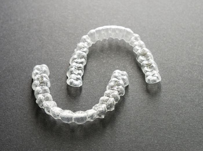10 häufige Fragen zu Clear Alignern – ehrlich beantwortet