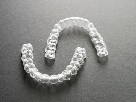 10 häufige Fragen zu Clear Alignern – ehrlich beantwortet
