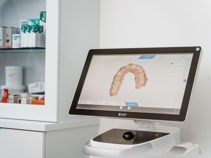 Häufige Fragen zu CEREC – verständlich erklärt