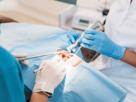 Wie setzt man ein Implantat? – Schritt-für-Schritt erklärt