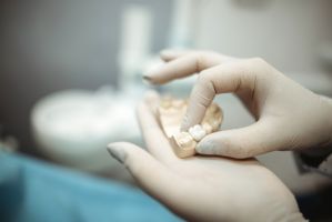 Metall oder Keramik? Was Sie bei Zahnkronen wissen sollten