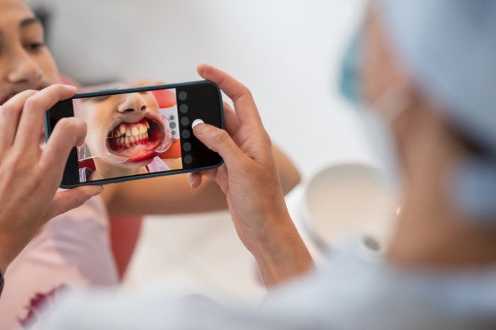 Warum Zahnputztrends aus Social Media manchmal mehr schaden als helfen