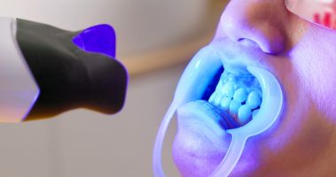 Implantate bei wenig Knochen – welche Möglichkeiten gibt es heute?