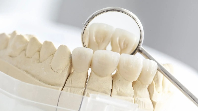 Kiefer Zähne und Spiegel