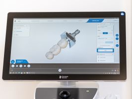 CEREC vs. klassische Kronen – Die Vorteile der digitalen Technologie